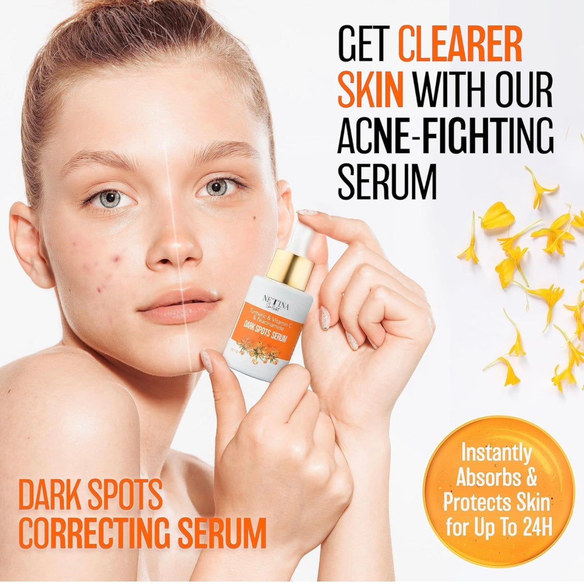 FaceTreasures Turmeric & Vitamin C Serum - Brightening Lightening Formula for Dark Spot Reduction