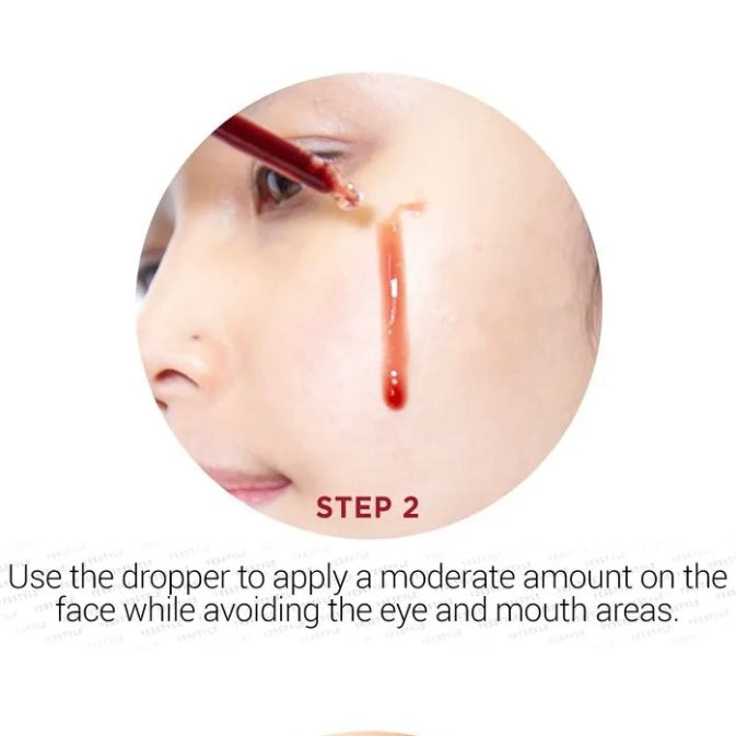 Renacimiento de la piel radiante: exfoliación facial de vampiro profesional totalmente natural con AHA + BHA