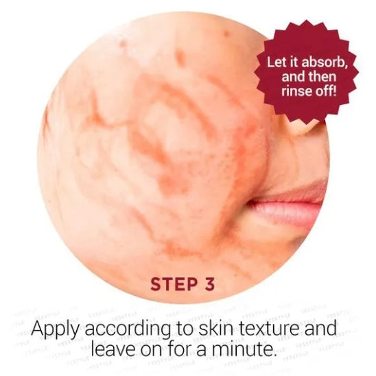 Renacimiento de la piel radiante: exfoliación facial de vampiro profesional totalmente natural con AHA + BHA