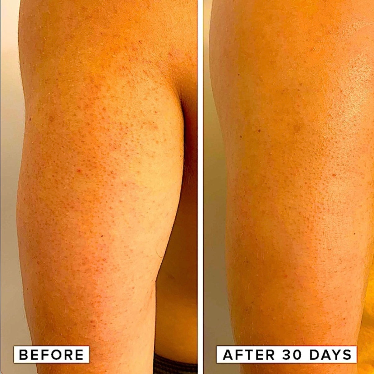 Suero rejuvenecedor Farmacy Honeymoon Glow Body AHA/BHA | Tamaño completo 4,7 onzas.