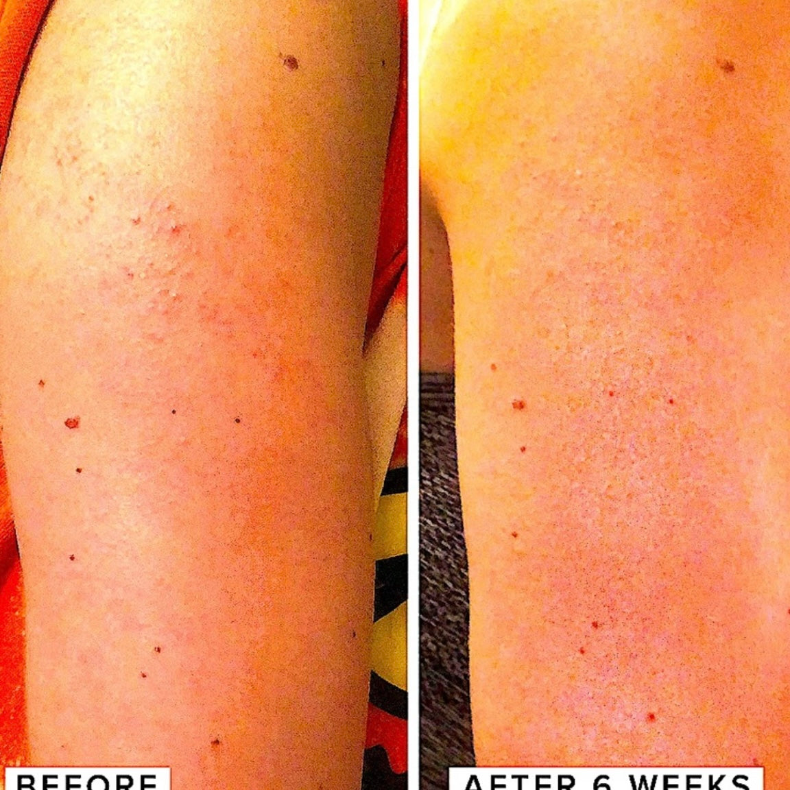 Suero rejuvenecedor Farmacy Honeymoon Glow Body AHA/BHA | Tamaño completo 4,7 onzas.