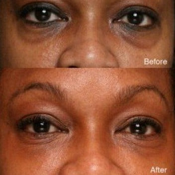 Skin Nutritions Age Defy Dark Circle & Puffiness Treatment Serum Roller