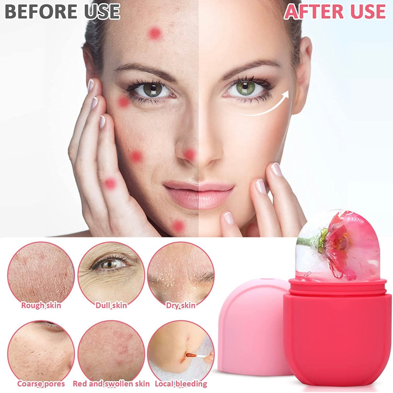 Luxury Skin Enhancing Facial Skin Care Ice Roller