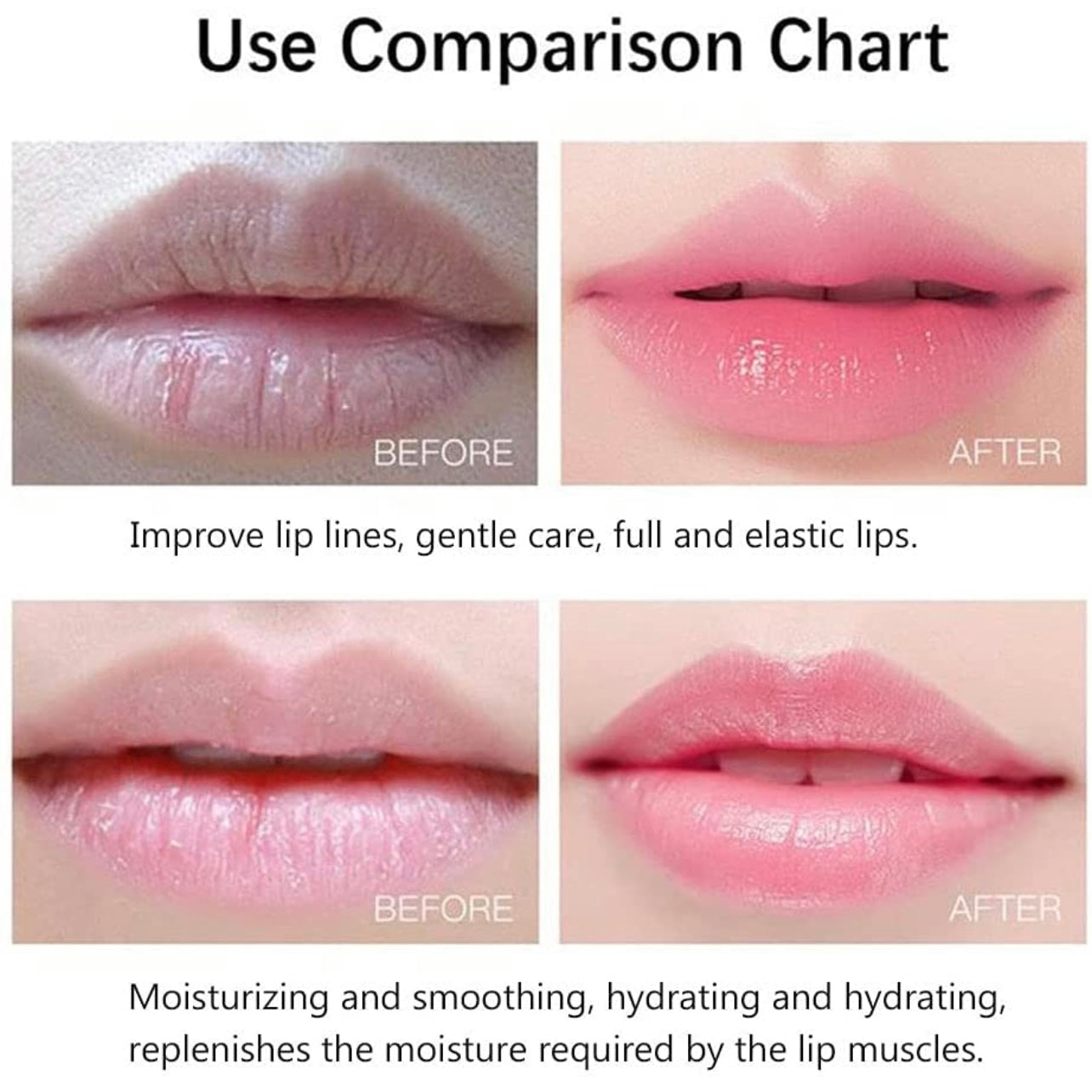 20 PIECE KOREAN LIP TREATMENT MASK SET