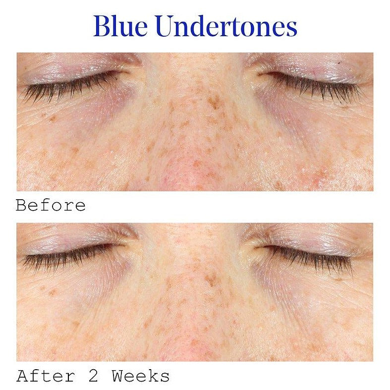Firming, smoothing, de-puffing and hydrating this lightweight Super Eye Serum refreshes and fortifies the fabric of fragile skin. Its lightweight texture is Instantly absorbed around the skin leaving a cooling and refreshed feeling. Biotin and Collagen stimulate the synthesis of collagen and skin-plumping hyaluronic acid