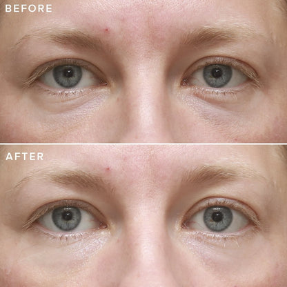 Farmacy Cheer Up Brightening Eye Cream 15ml , This Powerful brightening blend & potent formula visibly firms and smooths the look of fine lines with 4% vitamin C, natural peptides and caffeine. Instant radiance. Hyaluronic acid and three types of vitamin C, including acerola cherry, rejuvenate the eye contour and help reduce the appearance of dark circles. Fast-absorbing. Sinks into skin quickly and doesn’t pill under makeup.