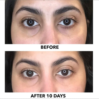 Algenist triple algae eye renewal balm with multi peptide complex and formulated with Alguronic acid in the full size 15ml size. currently sold at Facetreasures Boutique at Facetreasures.com All items ship out the same day you order with a free full size gift