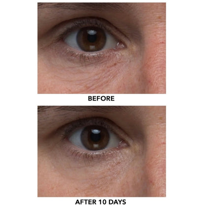 Algenist triple algae eye renewal balm with multi peptide complex and formulated with Alguronic acid in the full size 15ml size. currently sold at Facetreasures Boutique at Facetreasures.com All items ship out the same day you order with a free full size gift